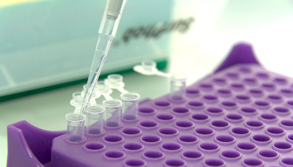 Kleine Reaktionsgefäße werden gerade mit Hilfe einer Pipette befüllt.