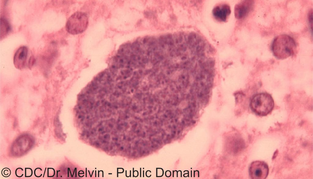 Mikroskop-Aufnahme: Histopathologie der exoerythrozytären Form eines Plasmodium-Parasiten.